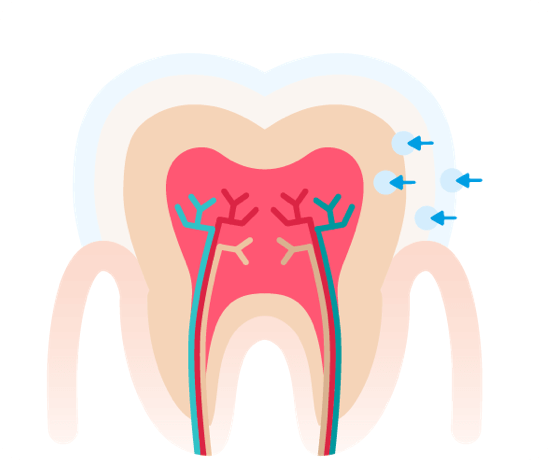 prophylaxe fluoridierung